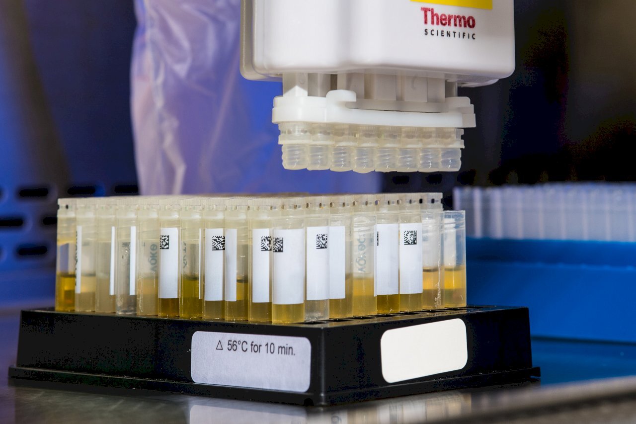 No se debe ignorar la hematuria